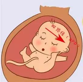 产检b超单怎么看,产检b超单上有哪些数据