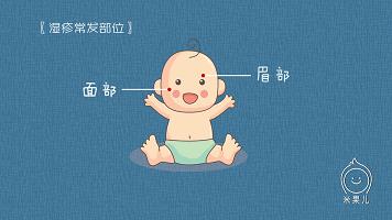 宝宝过敏怎么办新手爸妈秘籍,妈妈过敏体质宝宝怎么办