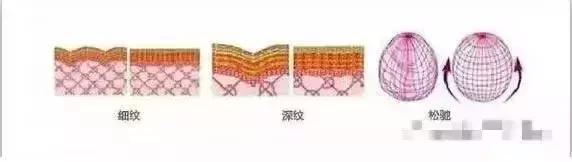 做完线雕真的会年轻吗,经常做线雕面部会年轻吗