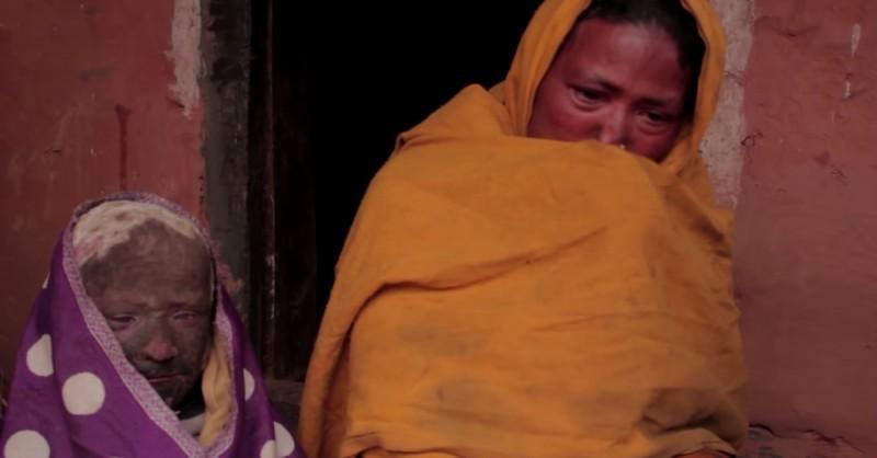 小男孩一出生无鼻无耳无眼,小男孩一出生奇丑无比