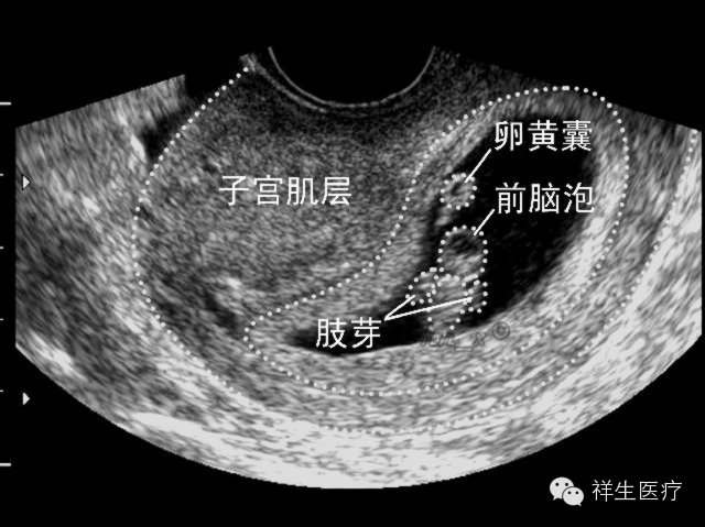 准妈妈看过来孕期瑜伽,孕期b超知识大全