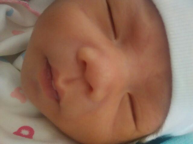 顺产胎儿呛到羊水是怎么回事,孕妇顺产不用力