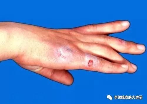 杏林微科普预防秋燥的方法,杏林科普有哪些小活动