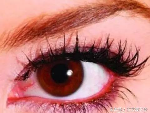 去眼袋的艾灸方法,孩子眼圈黑眼袋大怎么艾灸