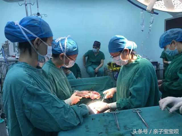 小心孕妇的这三种症状,最危险的五种孕妈