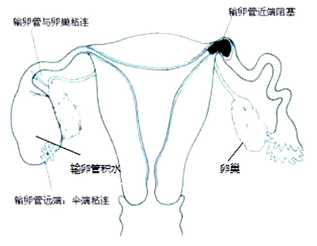 孕期肚子疼要做什么检查,怀孕初期肚子疼怎么排除宫外孕