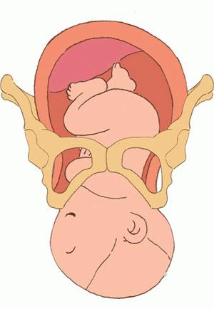 孕妇大肚子在水中分娩过程,中国孕妇在水中分娩过程