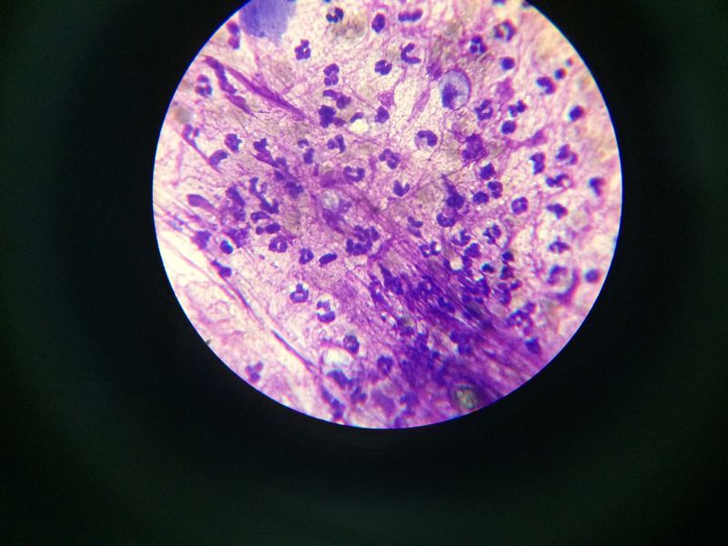 宠物医生如何预防狂犬病,宠物猫狗在什么环境下会得皮肤病