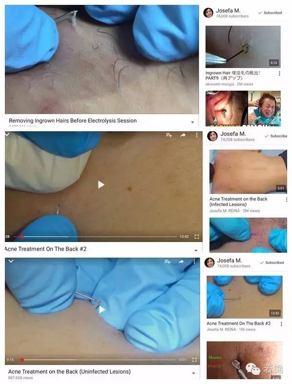 有挤黑头的工具吗,挤黑头工具好物分享