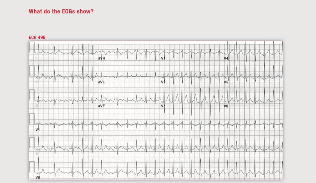 读心有术视频讲解,读心有术十二句话