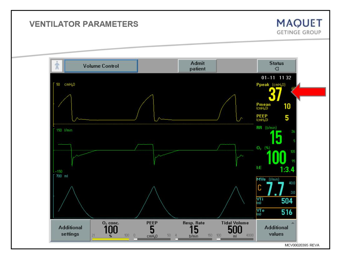 呼吸机基础知识最终版,呼吸机临床设置方法
