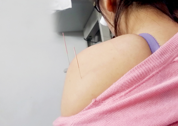 推拿系列之肩关节周围炎