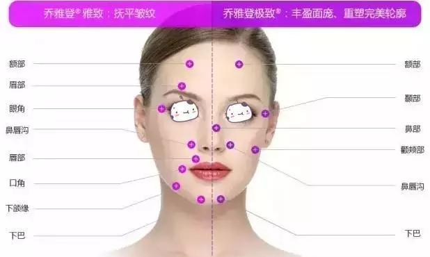 樱花和玻尿酸哪个好,玻尿酸最好的一款