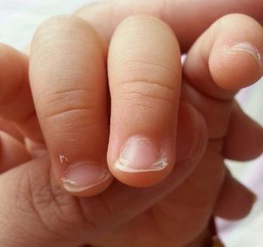 宝宝的健康也可从指甲中判断,宝宝指甲不健康的六个表现