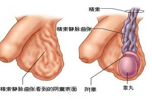 男人“蛋蛋”越大越好？小心这几种病！