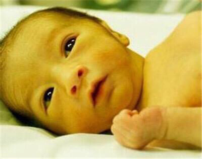 益生菌对黄疸作用,新生儿黄疸益生菌怎么吃