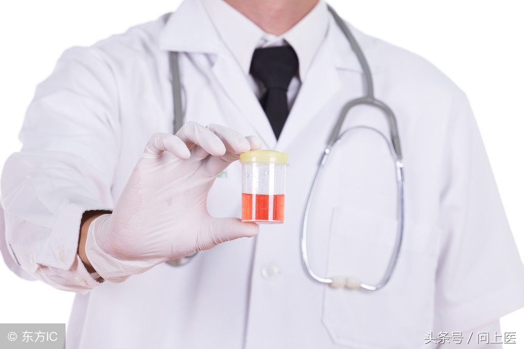 免疫球蛋白a偏高和补体c3偏低,免疫球蛋白检测结果高