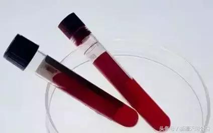 正确认识艾滋病从终止谣言开始,消除艾滋病不必要的恐惧