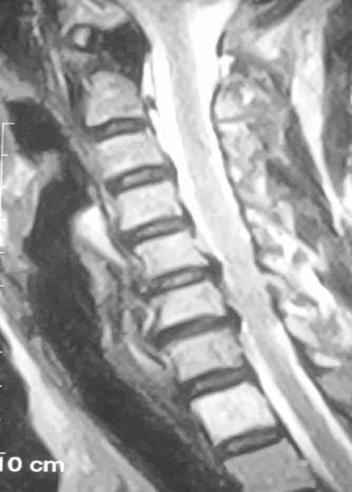 宣武医院头痛专家排名,宣武医院治疗头痛
