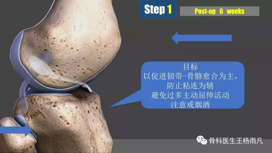 侧副韧带前叉断裂康复训练,前叉交叉韧带重建后多久能脱拐