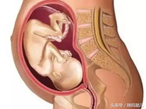 臀位胎儿入盆是什么感觉,胎儿入盆会有想拉大便的感觉吗