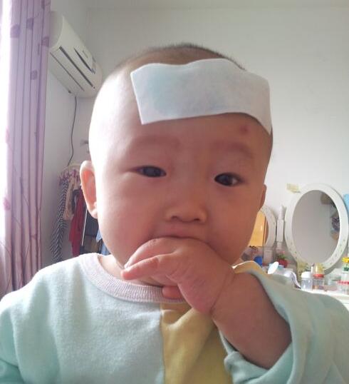 出疹子的症状和治疗方法,儿童出疹子最快治疗方法