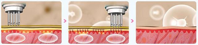 干皮用什么护肤品不容易脱妆,皮肤干燥容易过敏用什么粉底液