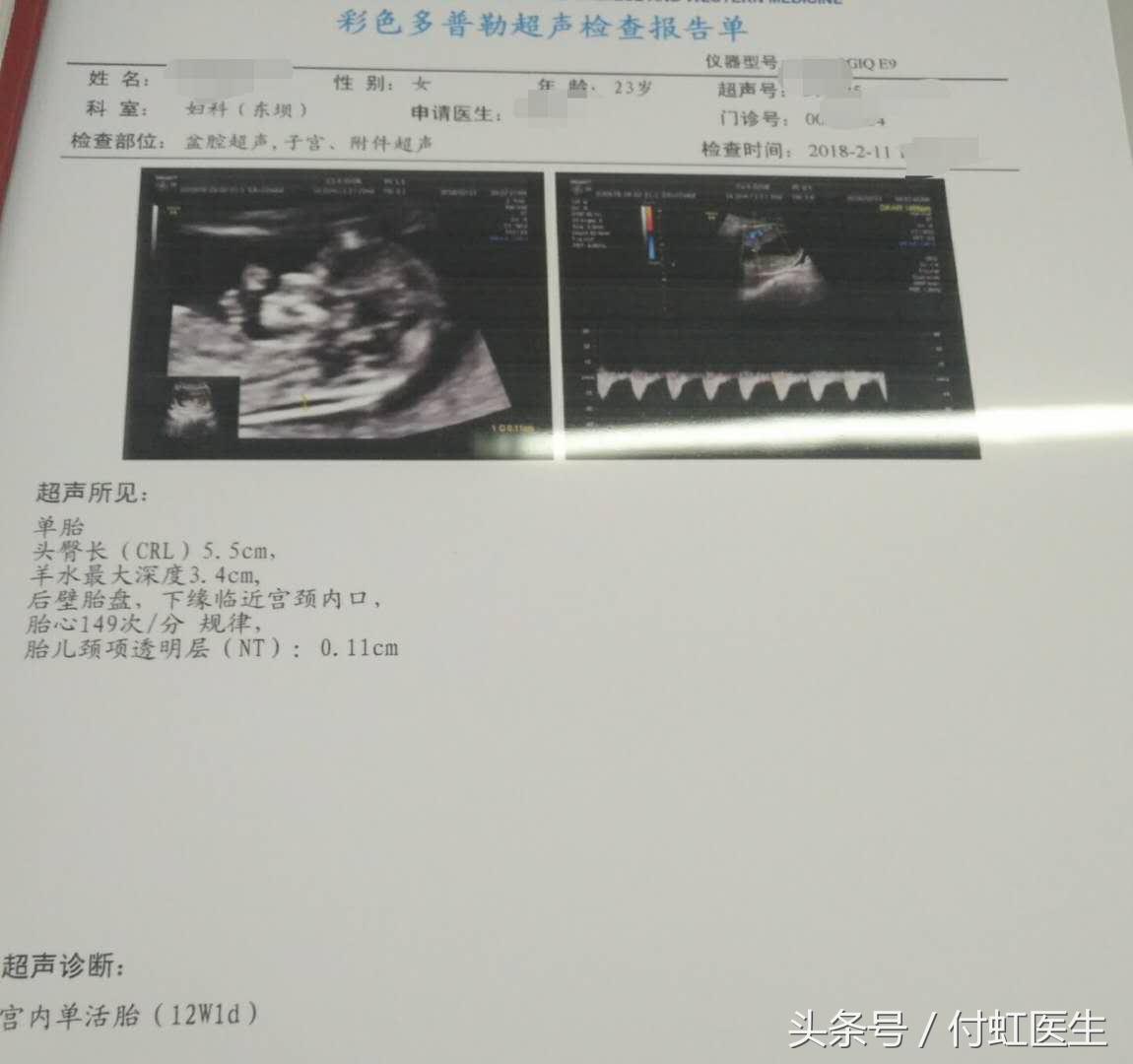 孕12周做B超胎盘位置低,我是得了导致宝宝缺氧的“前置胎盘”?