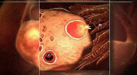 美国试管婴儿移植后14天内，胚胎到底都经历了什么？