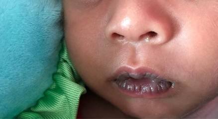 宝宝嘴唇发紫是什么原因引起的,宝宝嘴唇发紫是什么问题呢