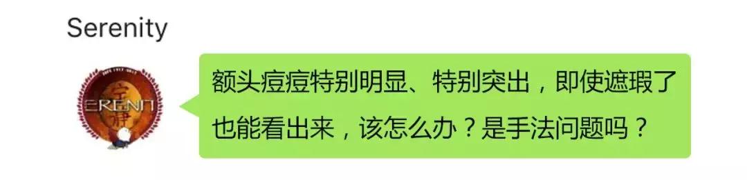 痘痘结痂起皮怎么遮瑕,脸上的痘痘遮瑕遮不住怎么办