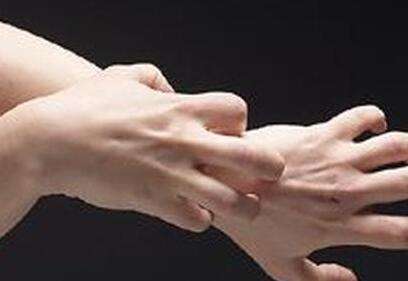 辗转三省拜年三岁男童全身脱皮似烫伤