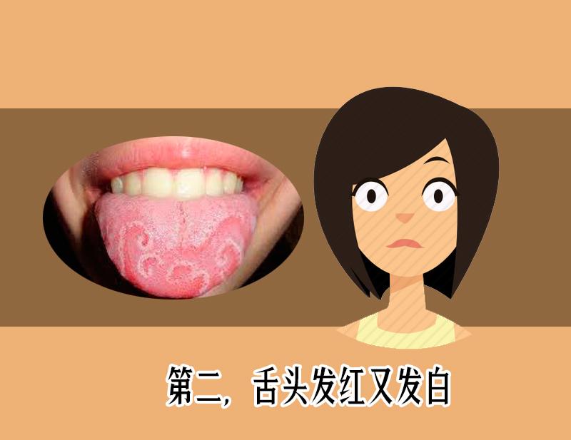 舌苔发黑辨证,舌苔发青警惕四种原因