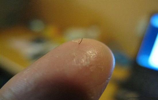 头发扎到眼睛肉里,头发扎在脚肉里怎么办