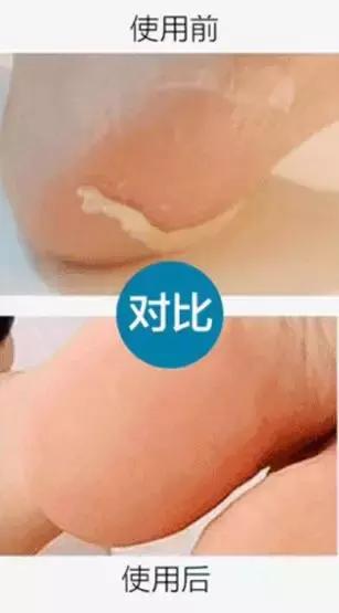 睡觉穿一只袜子,睡觉时穿一个袜子