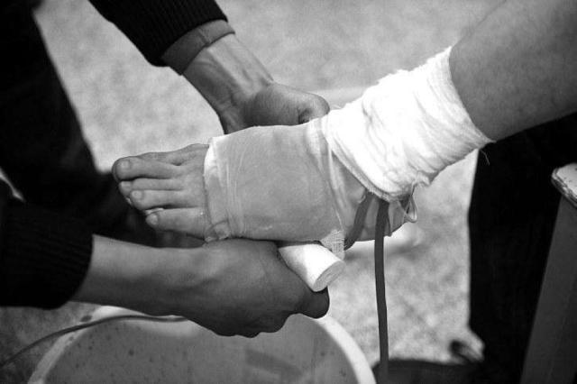 外伤出血应急处置技能实操,创伤应急救护正确的程序