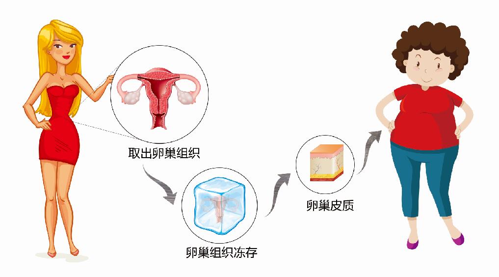 趣谈人体所有器官,卵巢组织冷冻有什么作用