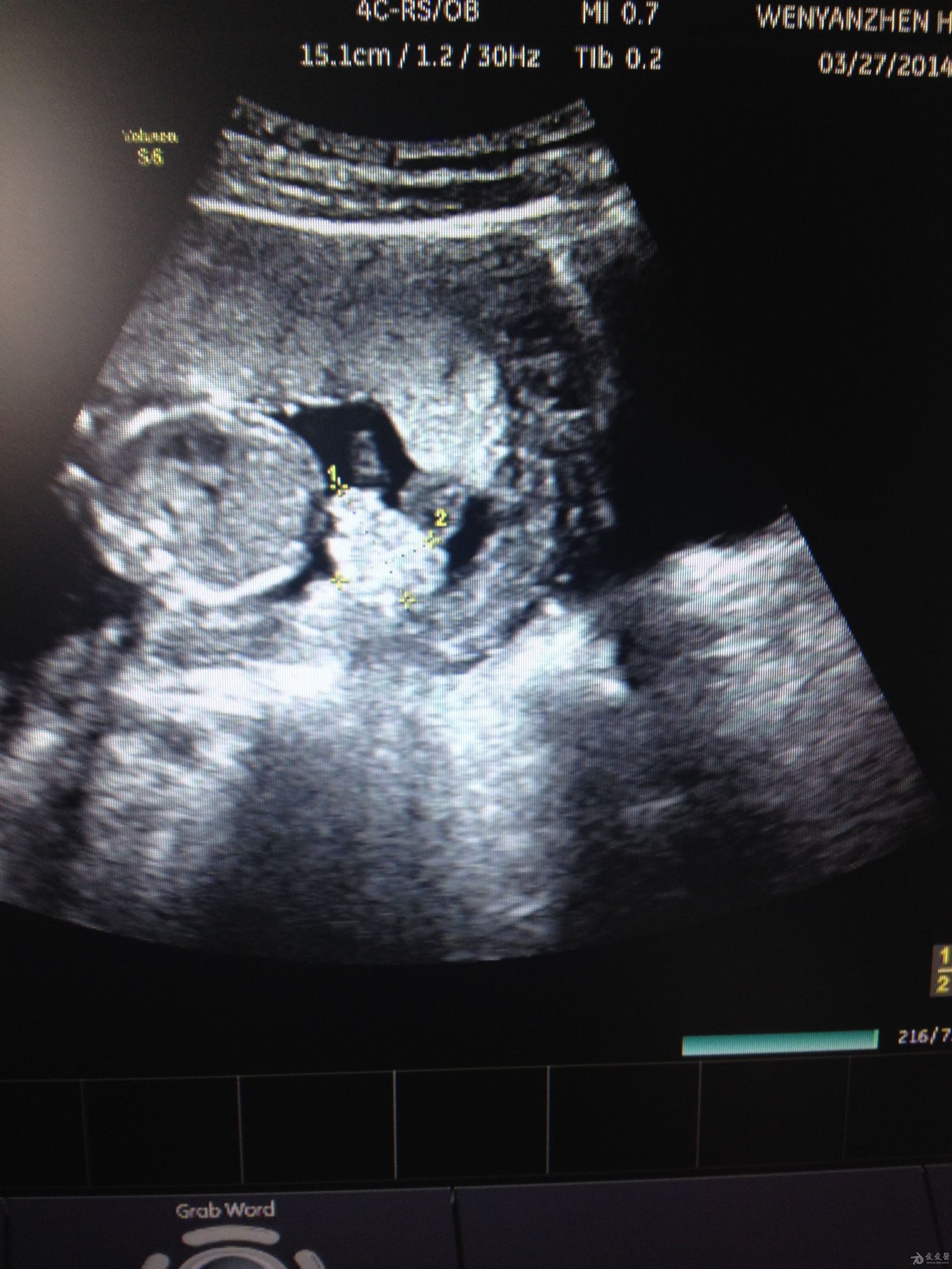 孕期羊水干货知识大全,孕妈妈产检资料收纳册