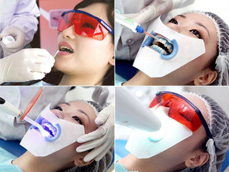 教你如何摆脱大黄牙,如何告别大黄牙