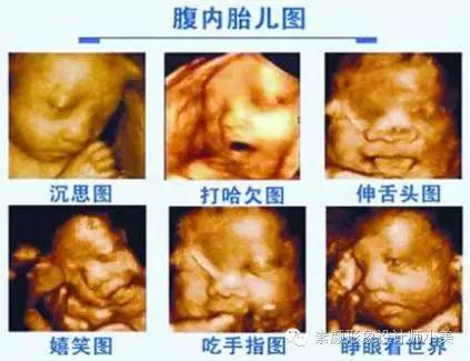 孕育学堂的直播间,孕育学堂直播