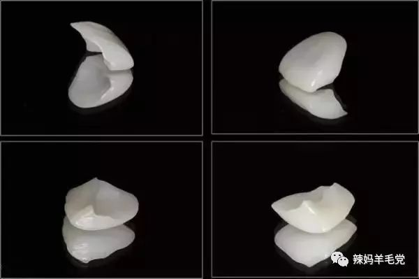 关于牙齿美白的微笑图片,迷人笑容牙齿矫正