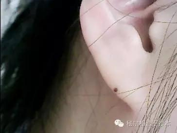 看耳朵知长相,如何看耳朵识别女人