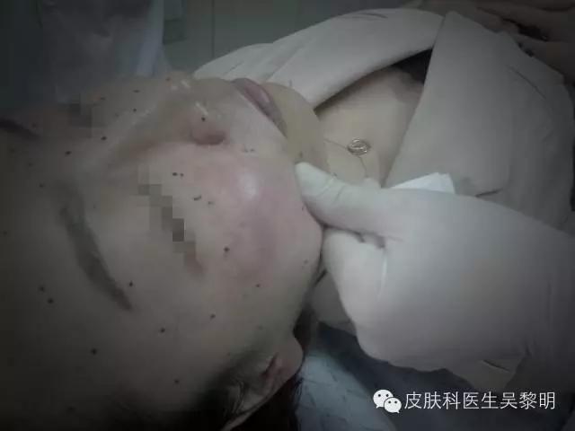 透明质酸护肤品功效,透明质酸是修复皮肤敏感成分