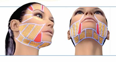 超声刀抗衰老真的有那么神奇吗,超声刀真的能抗老