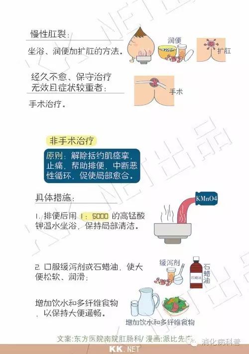 难以启齿的肛裂是怎么回事