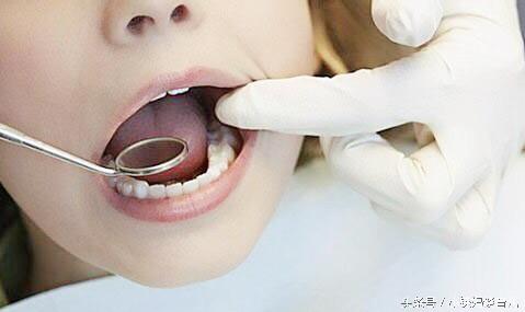 乳牙掉了没牙根怎么补牙,儿童乳牙龋齿烂了有必要补牙吗