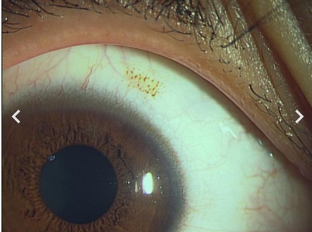 戴美瞳出事的视频,出事故的时候戴美瞳