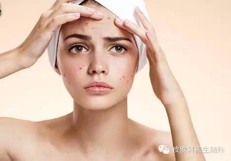 滚蛋吧痘痘君强迫症,滚蛋吧痘痘君图片