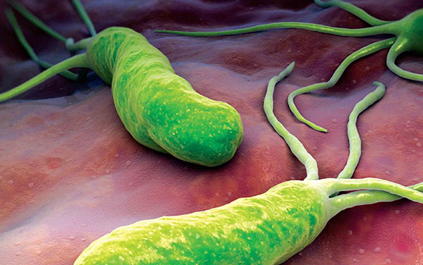 得了幽门螺旋杆菌就是胃癌对吗,感染幽门螺旋杆菌多久变成胃癌