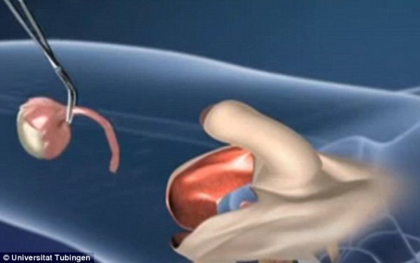 男人变性会遇到的问题,带你探索男生的小秘密